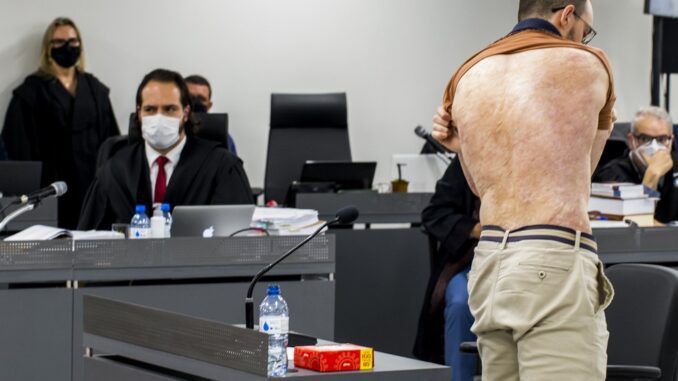 Delvani Rosso mostrou as cicatrizes das queimaduras que sofreu no incêndio da Kiss — Foto: TJ-RS